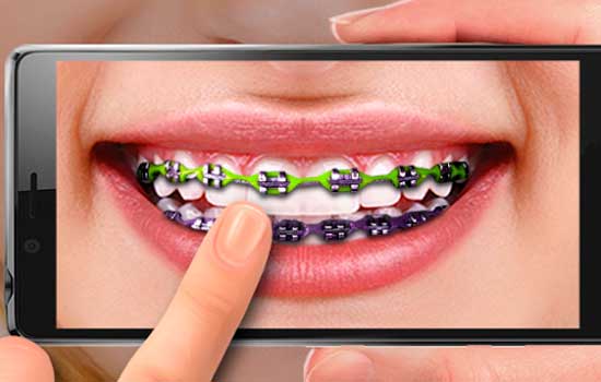 aparelho dentário pelo celular