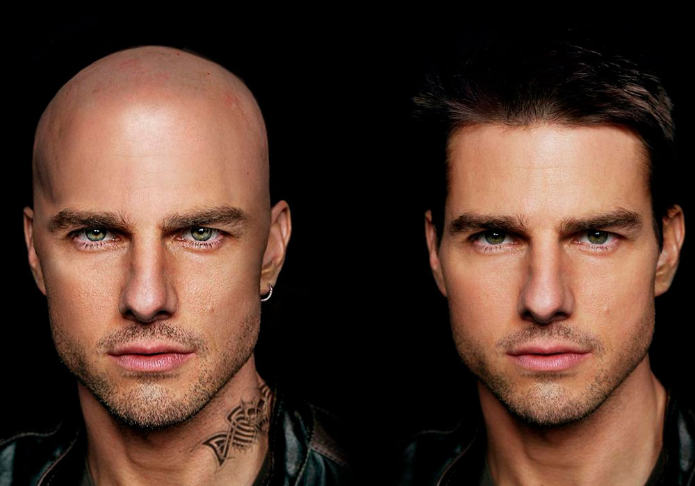 aplicativo que simula careca