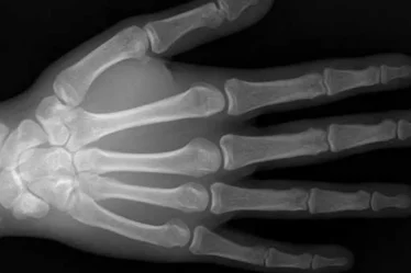 Aplicativo para fazer ultrassom pelo próprio celular