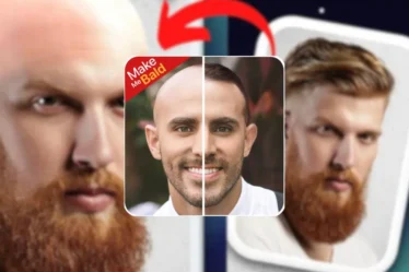 Aplicativo que deixa pessoas carecas